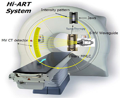 TomoTherapy TomoTherapy